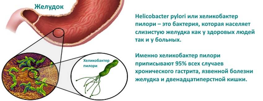 Хронический гастрит, вызванный helicobacter pylori | компетентно о здоровье на ilive