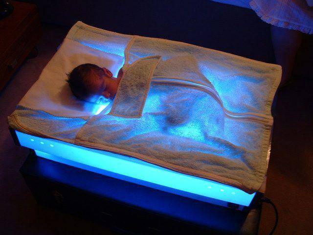 Лечение желтухи новорожденного в домашних условиях - топотушки