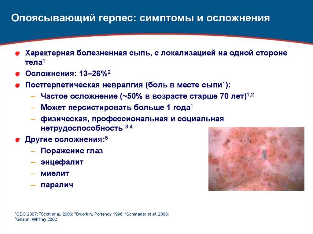 Энтеровирусная инфекция у детей: симптомы и лечение, как выглядит сыпь - фото