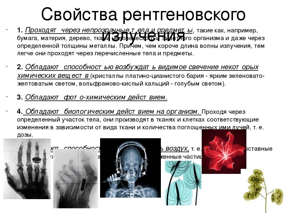 1.свойства рентгеновского изучения, используемые для получения рентгеновских изображений.
